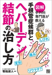 図解 手外科専門医が教える 手根管症候群とヘバーデン結節の治し方