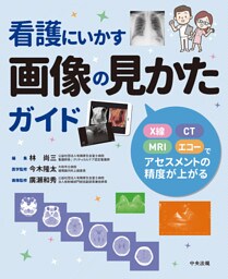 看護にいかす画像の見かたガイド　―Ｘ線・ＣＴ・ＭＲＩ・エコーでアセスメントの精度が上がる