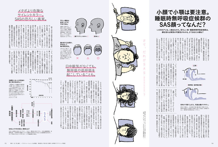 小顔で小顎は要注意。睡眠時無呼吸症候群のSAS顔ってなんだ？