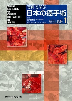 写真で学ぶ日本の癌手術〈VOLUME 1〉