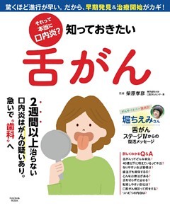 それって本当に口内炎？ 知っておきたい舌がん