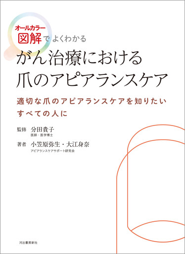 がん治療における爪のアピアランスケア　オールカラー図解でよくわかる