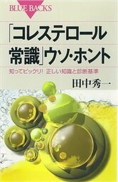 「コレステロール常識」ウソ・ホント　知ってビックリ！　正しい知識と診断基準
