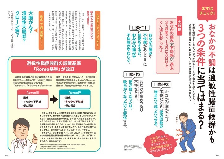 まずはチェック！　おなかの不調は過敏性腸症候群かも　３つの条件に当てはまる？