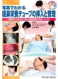 写真でわかる経鼻栄養チューブの挿入と管理 : 「医療安全全国共同行動」の推奨対策を実践するために…