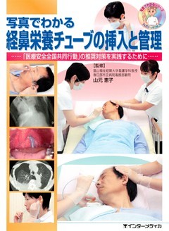 写真でわかる経鼻栄養チューブの挿入と管理 : 「医療安全全国共同行動」の推奨対策を実践するために…