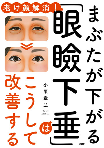 老け顔解消！ まぶたが下がる「眼瞼下垂」はこうして改善する