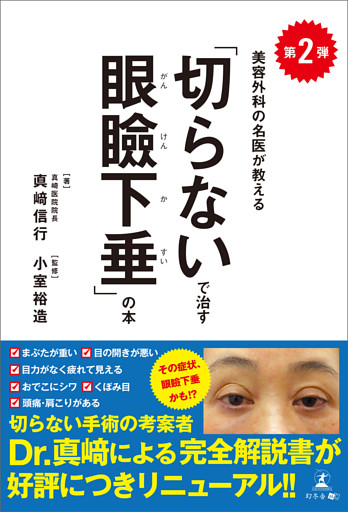 第２弾 美容外科の名医が教える「切らないで治す眼瞼下垂」の本