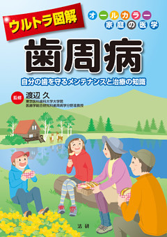 ウルトラ図解　歯周病