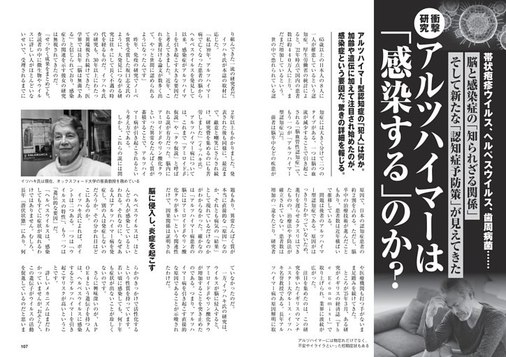 アルツハイマーは「感染する」のか？