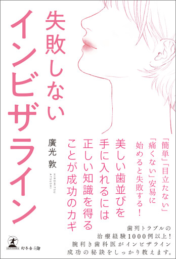 失敗しないインビザライン