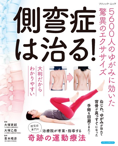 側弯症は治る！5600人のゆがみに効いた驚異のエクササイズ