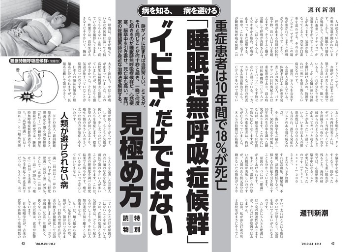 重症患者は10年間で18％が死亡　「睡眠時無呼吸症候群」“イビキ”だけではない見極め方