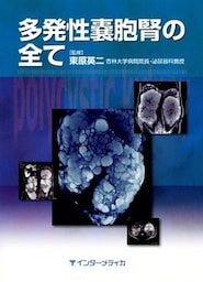 多発性嚢胞腎の全て