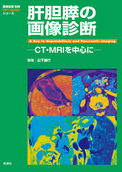 肝胆膵の画像診断