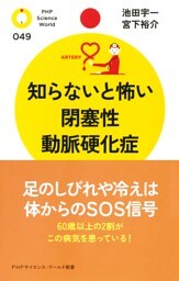 知らないと怖い閉塞性動脈硬化症