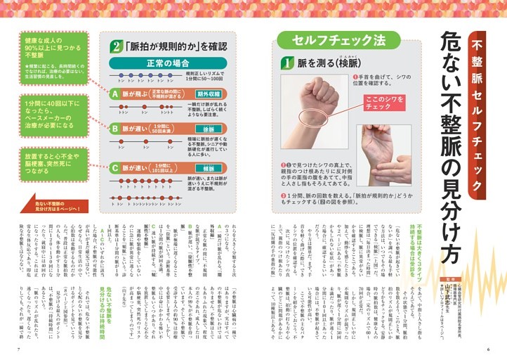 不整脈セルフチェック】危ない不整脈の見分け方 (ムック・増刊) | d