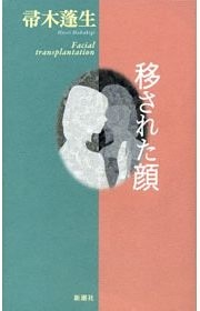 移された顔