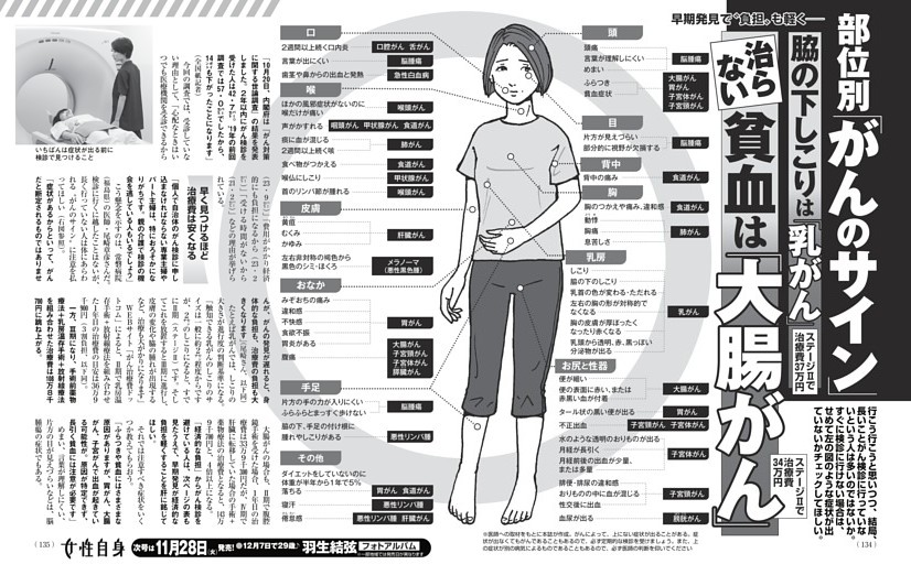 部位別「がんのサイン」 脇の下しこりは「乳がん」 治らない貧血は「大腸がん」