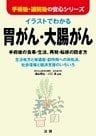 イラストでわかる胃がん・大腸がん ： 手術後の食事・生活、再発・転移の防ぎ方