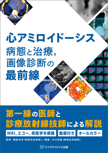 心アミロイドーシス　病態と治療，画像診断の最前線