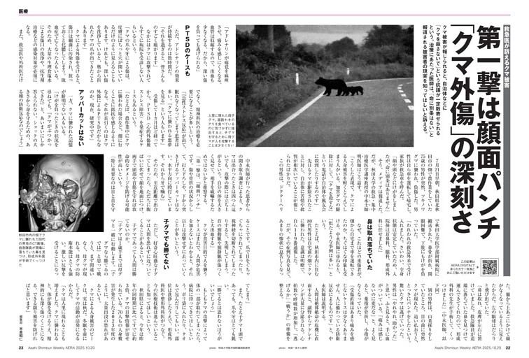 救急医が訴えるクマ被害 第一撃は顔面パンチ「クマ外傷」の深刻さ