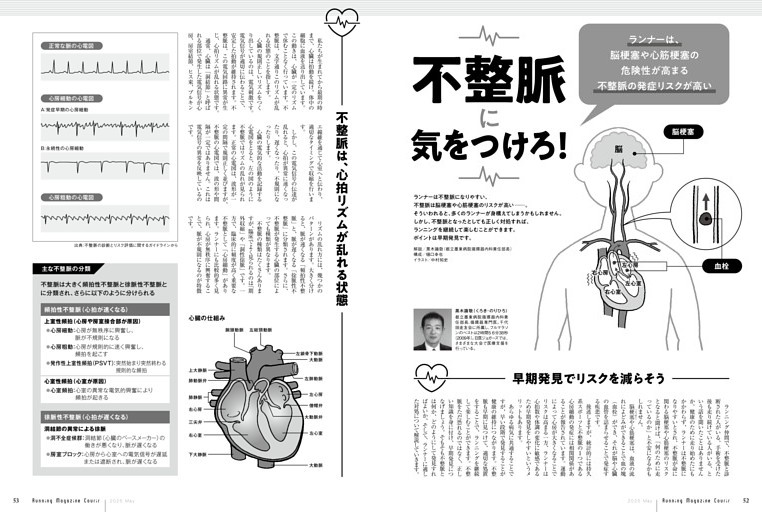 【ランナーは発症リスクが高い】不整脈に気をつけろ！○解説／黒木識敬（都立墨東病院循環器内科責任部長）